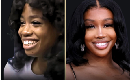 SZA’s Stunning Transformation: The Truth Behind the Plastic Surgery